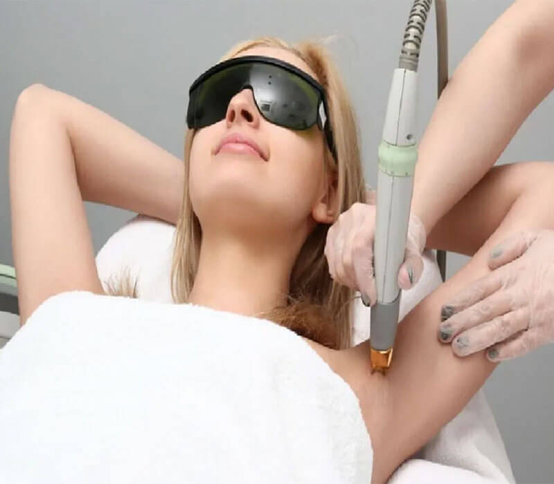 laser hair removal in south Delhi