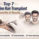Lifeline Follicular Transplantation